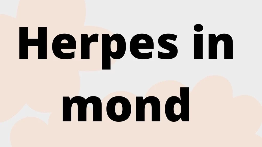 Herpes in mond