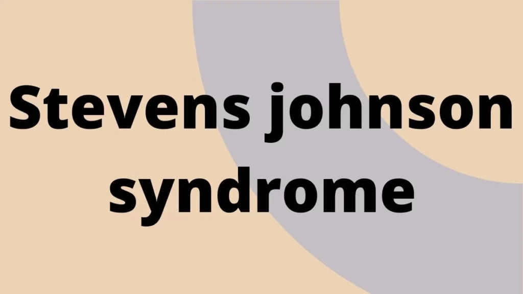Stevens johnson syndrome