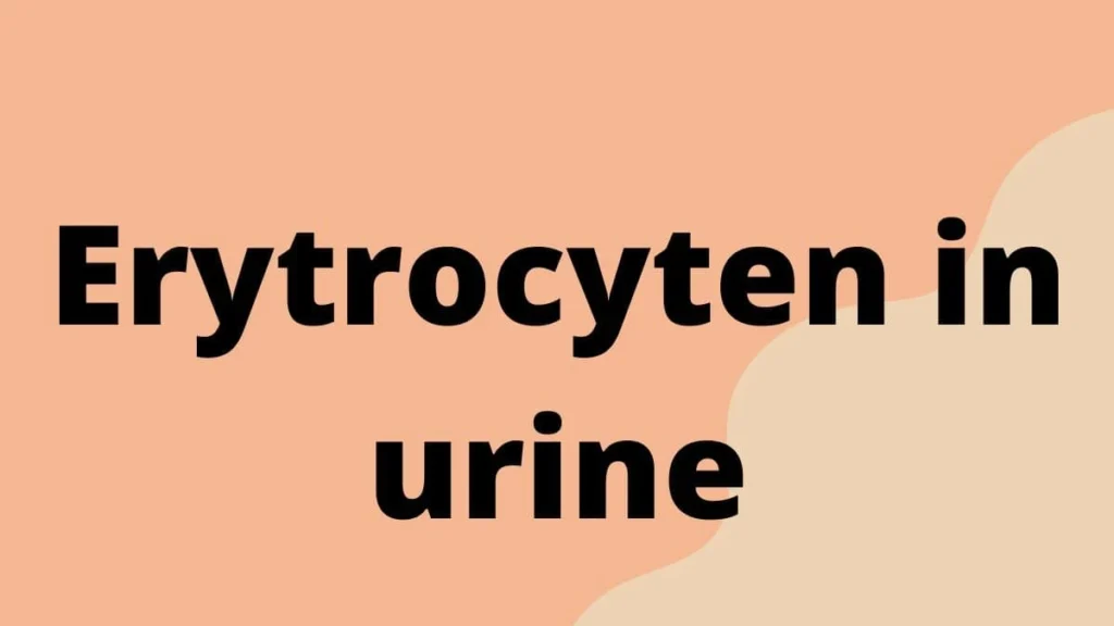 Erytrocyten in urine