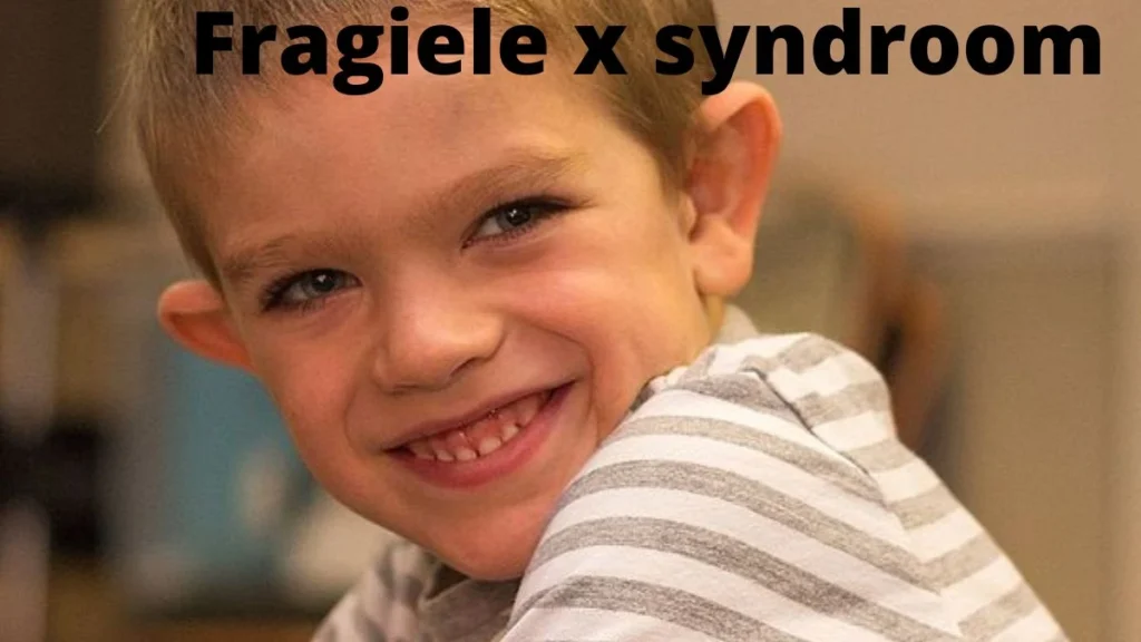 Fragiele x syndroom : Symptomen en behandeling